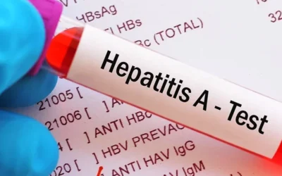 Waspadai Gejala Hepatitis A, Penyebab dan Cara Penularannya