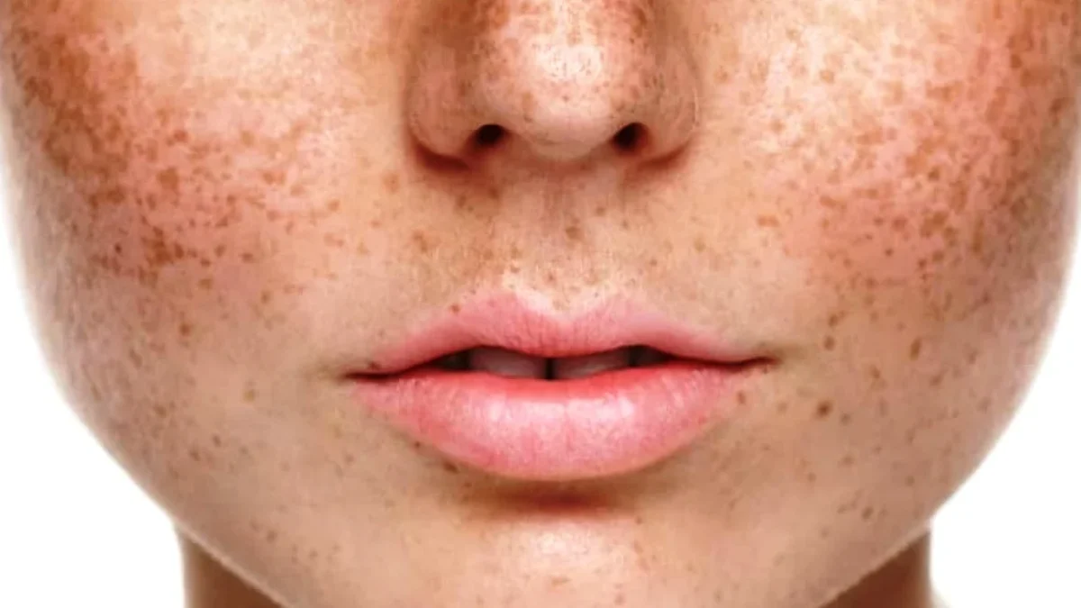 5 Cara Menghilangkan Bintik Hitam di Wajah dengan Bahan Alami